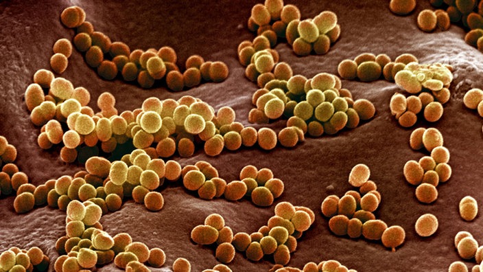 Elektronenrastermikroskopie von Bakterien