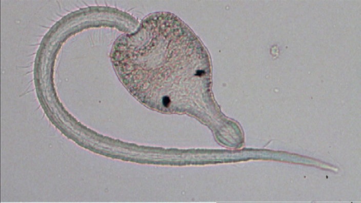 Mikroskopaufnahme eines halb durchsichtigen Wurmes.