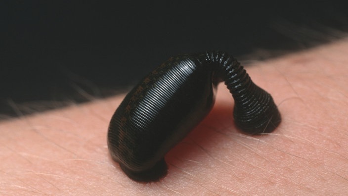 Medizinischer Blutegel (Hirudo medicinalis) saugt Blut an einem Menschen 